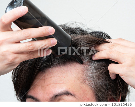 A man applying a hair restorer to his scalp Scalp care A man applying a hair restorer to his scalp Scalp care 101815456