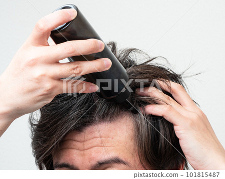 A man applying a hair restorer to his scalp Scalp care 101815487