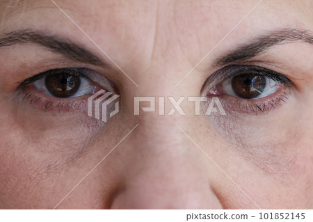 Senior woman face with dark brown eyes and wrinkles 101852145