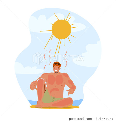 Man Grimacing In Pain From Sunburn On Beach, Red And Inflamed Skin, Seeking Relief And Shade From The Scorching Sun Man Grimacing In Pain From Sunburn On Beach, Red And Inflamed Skin, Seeking Relief And Shade From The Scorching Sun 101867975