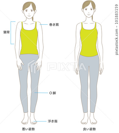 正面看姿勢好壞的女人 正面看姿勢好壞的女人 101883159