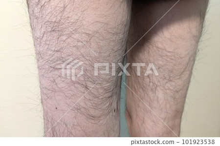 大腿後部有蓬鬆的脛毛 大腿後部有蓬鬆的脛毛 101923538