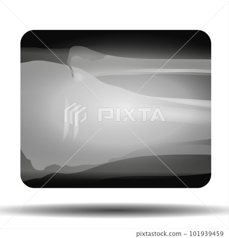 X-ray of the Knee Joint 101939459