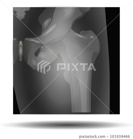 X-Ray of Deformities 101939466