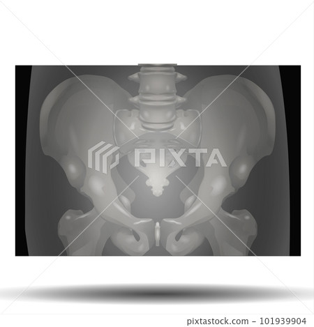 X-Ray of Pelvis 101939904