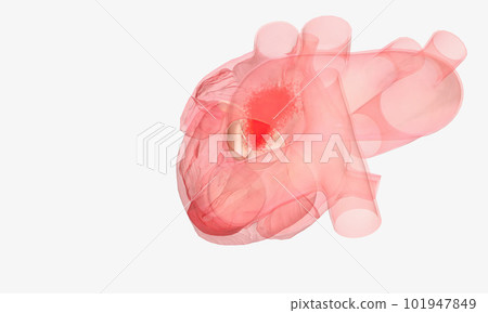 Normal Aortic Valve Function 101947849