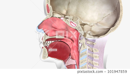 Canker sores (also called aphthous ulcers) are small, round sores on the inside of the mouth or base of the gums. Canker sores (also called aphthous ulcers) are small, round sores on the inside of the mouth or base of the gums. 101947859