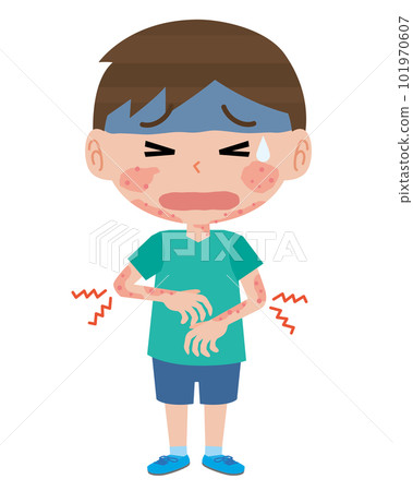 boy with atopic dermatitis 101970607