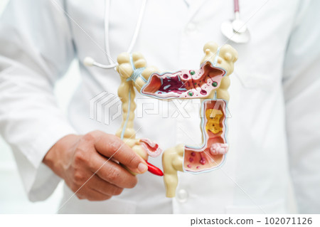 Intestine, doctor holding anatomy model for study diagnosis and treatment in hospital. Intestine, doctor holding anatomy model for study diagnosis and treatment in hospital. 102071126