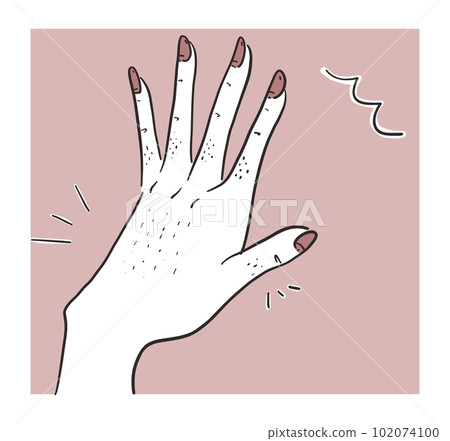 患有多餘腋毛的年輕女性 102074100