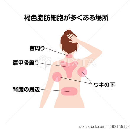 Area with many brown fat cells / female upper body illustration vector illustration Area with many brown fat cells / female upper body illustration vector illustration 102156194