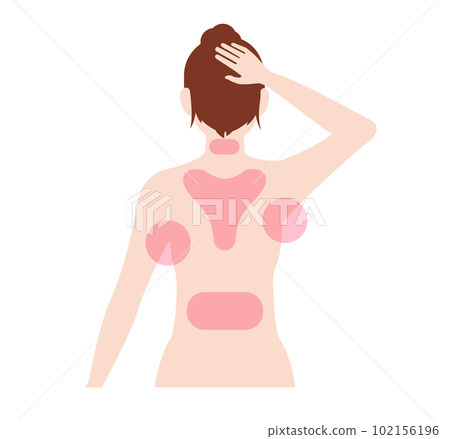 Area with many brown fat cells / female upper body illustration vector illustration (no text) Area with many brown fat cells / female upper body illustration vector illustration (no text) 102156196