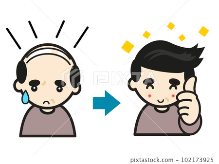 A man who is pleased with his hair growth 102173925