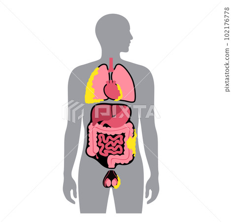 Mesothelioma tumor types Mesothelioma tumor types 102176778