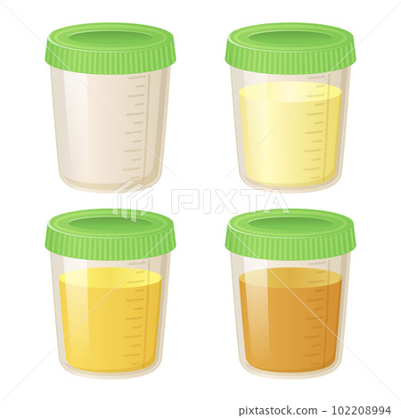 Pee in a plastic container set. Collection of Urine Analysis Vials in Various Colors from Clear to Yellow - Flat Cartoon Style Vector Illustration isolated on white background. Pee in a plastic container set. Collection of Urine Analysis Vials in Various Colors from Clear to Yellow - Flat Cartoon Style Vector Illustration isolated on white background. 102208994