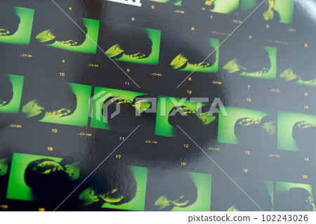 Betta-yaki 102243026