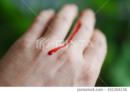 blood from a wound on arm on the background of plants 102268136
