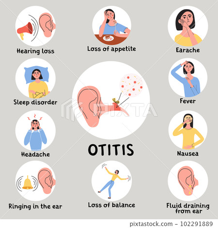 Otitis or tinnitus symptoms. Earache becouse of infection in the middle ear. Inflammatory diseases. Infografic with woman character. Flat vector medical illustration Otitis or tinnitus symptoms. Earache becouse of infection in the middle ear. Inflammatory diseases. Infografic with woman character. Flat vector medical illustration 102291889