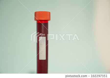 A sample of human blood in a test tube in a medical laboratory, ready for testing. background illustration of healthcare. High quality photo A sample of human blood in a test tube in a medical laboratory, ready for testing. background illustration of healthcare. High quality photo 102297351