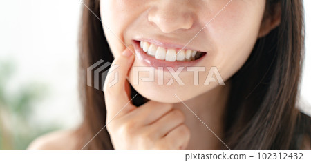 Beauty teeth whitening women Beauty teeth whitening women 102312432