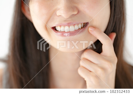 Beauty teeth whitening women Beauty teeth whitening women 102312433