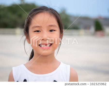 close up shot of face asian child cute or kid girl smiling eyes white teeth and one broken tooth or drop from baby or milk tooth on 7 years old close up shot of face asian child cute or kid girl smiling eyes white teeth and one broken tooth or drop from baby or milk tooth on 7 years old 102325962