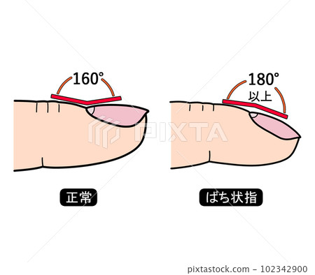 鼓槌指（帶字母） 102342900