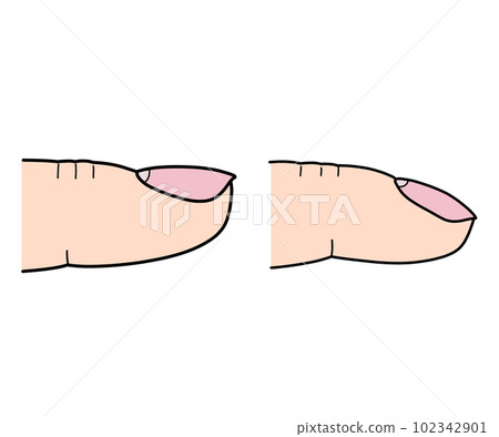 Drumstick finger (no letters) 102342901