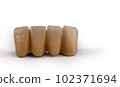 The Perfect Smile: Enhancing Dental Aesthetics with Brown Crowns 102371694