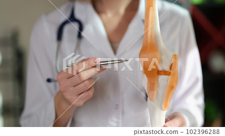 Woman doctor demonstrating human anatomy model of knee, knee-joint 102396288