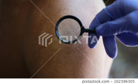Doctor hand holding magnifier glass and examining patient shoulder 102396305