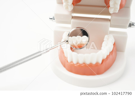 Teeth model showing an implant dental demonstration teeth study teach model on white background. Teeth model showing an implant dental demonstration teeth study teach model on white background. 102417790