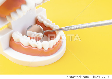 Teeth model showing an implant dental demonstration teeth study teach model on yellow background. 102417794