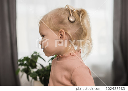 Funny baby with cochlear implant. Hear aid and medicine innovating technology and diversity concept 102428683