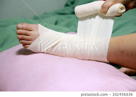Concept of bandaging and treating an ankle injury at home Concept of bandaging and treating an ankle injury at home 102456836