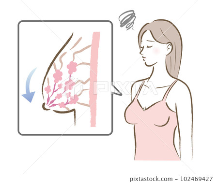Illustration of a sagging bust and a worried woman Illustration of a sagging bust and a worried woman 102469427
