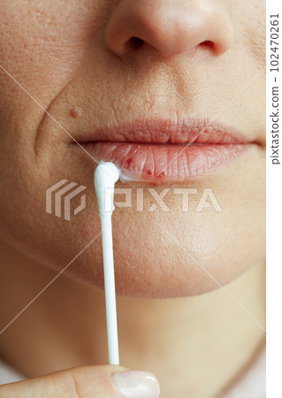 Woman applying ointment using cotton swab on beige 102470261