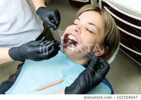 Checkup at dentist. Retractor in patient's mouth Checkup at dentist. Retractor in patient's mouth 102504647