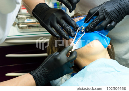 Isolate patient's teeth with rubber pad. Isolate patient's teeth with rubber pad. 102504668