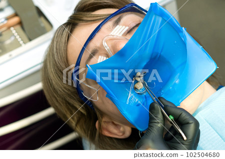 Restoration chewing surface with photopolymer 102504680