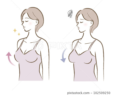 Illustration of an adult woman with a firm bust and a sagging bust before and after 102509250