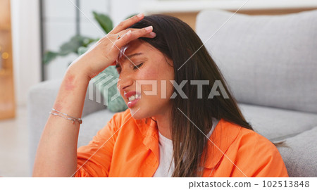 Woman, headache and pain in home with stress, dizzy mind and mental health crisis. Sick female with migraine, tension and anxiety in brain of burnout, medical problems and frustrated face in lounge 102513848