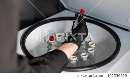 The doctor takes out a test tube with blood plasma from the centrifuge. Plasma lifting procedure for skin rejuvenation. The doctor takes out a test tube with blood plasma from the centrifuge. Plasma lifting procedure for skin rejuvenation. 102556559
