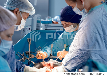 Team of surgeons carefully performing surgery using precise instruments in the operating room save the life of the patient, clear teamwork Team of surgeons carefully performing surgery using precise instruments in the operating room save the life of the patient, clear teamwork 102576847