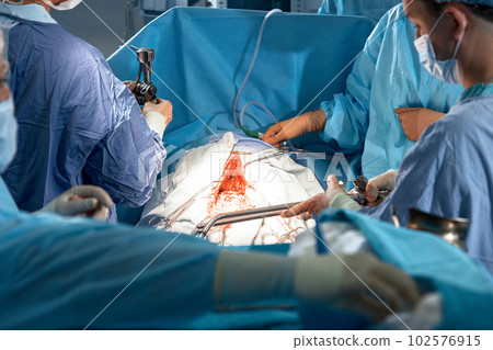 Team of surgeons carefully performing surgery using precise instruments in the operating room save the life of the patient, clear teamwork 102576915