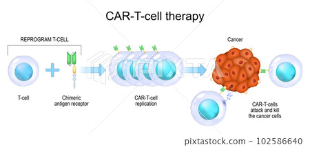 CAR T-cell therapy. cancer immunotherapy. CAR T-cell therapy. cancer immunotherapy. 102586640