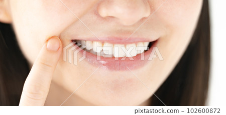 牙齒美白牙齒對齊 102600872