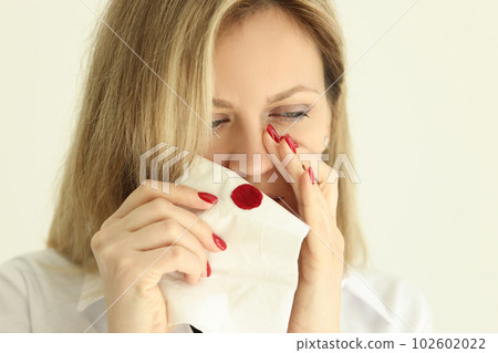 Woman wipes bleeding nose with paper napkin in light room Woman wipes bleeding nose with paper napkin in light room 102602022