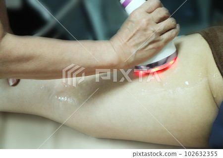 大腿治療 102632355