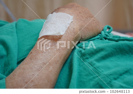 長照 長照 102648113